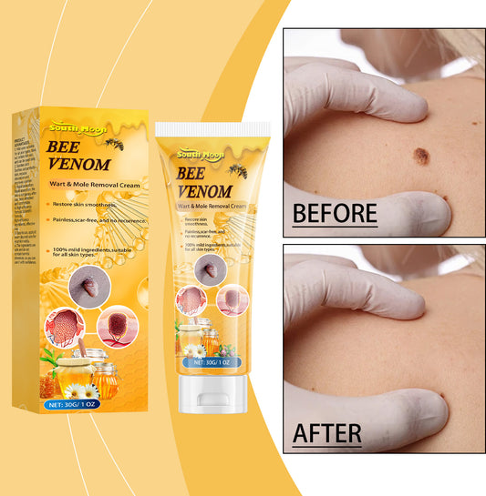 Bee Venom Skin Tag Remover Cream
