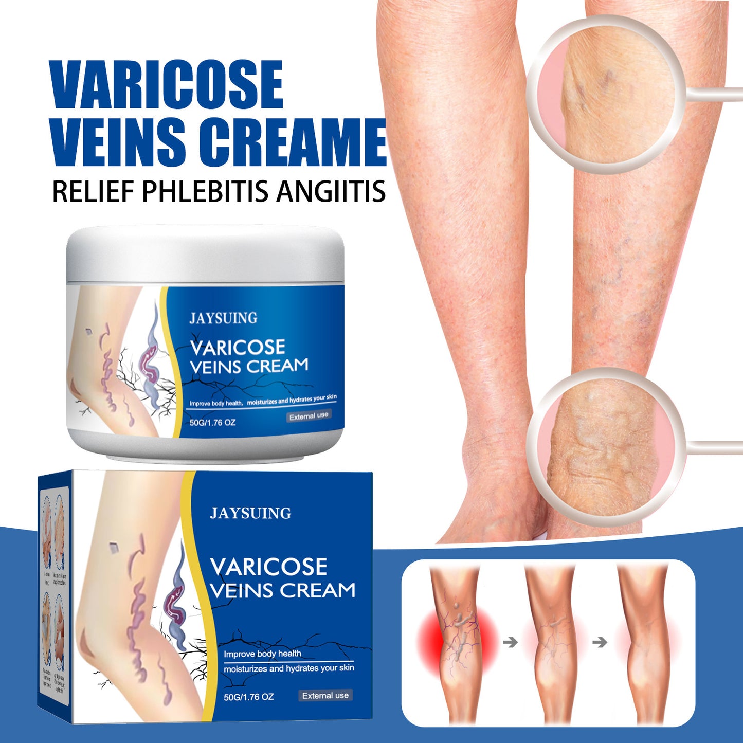 Leg Vein Repair Cream