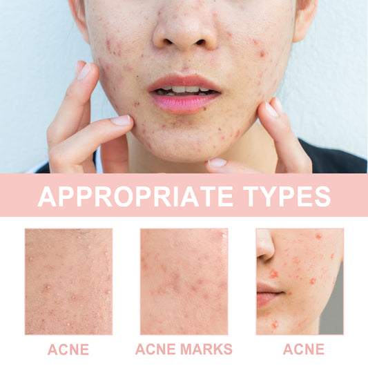 Acne Repair & Pore Cleansing Patch