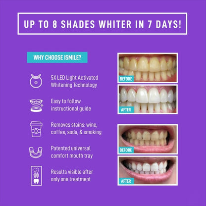 LED Teeth Whitening Kit