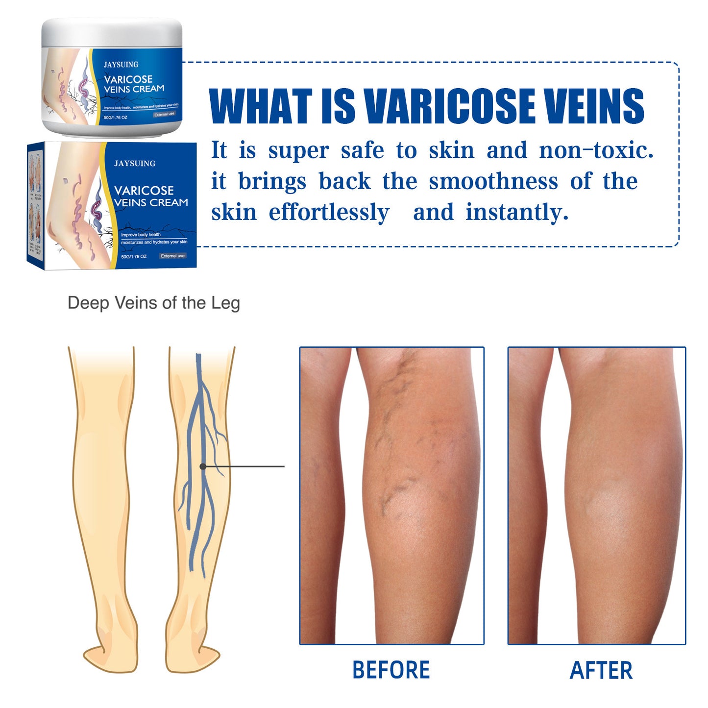 Leg Vein Repair Cream
